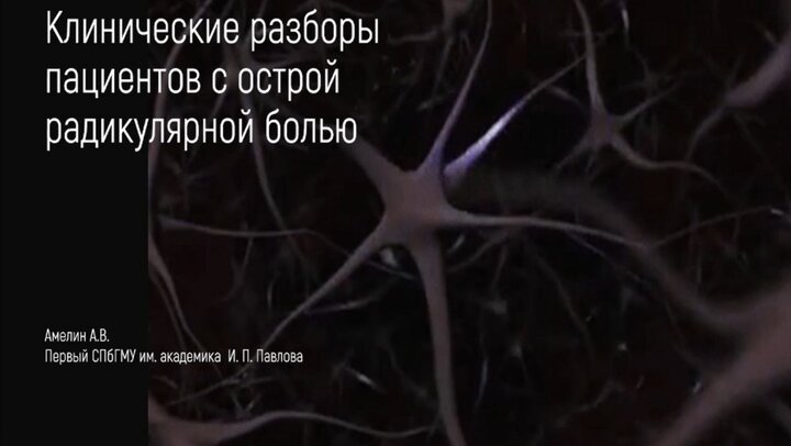 Острая радикулярная боль